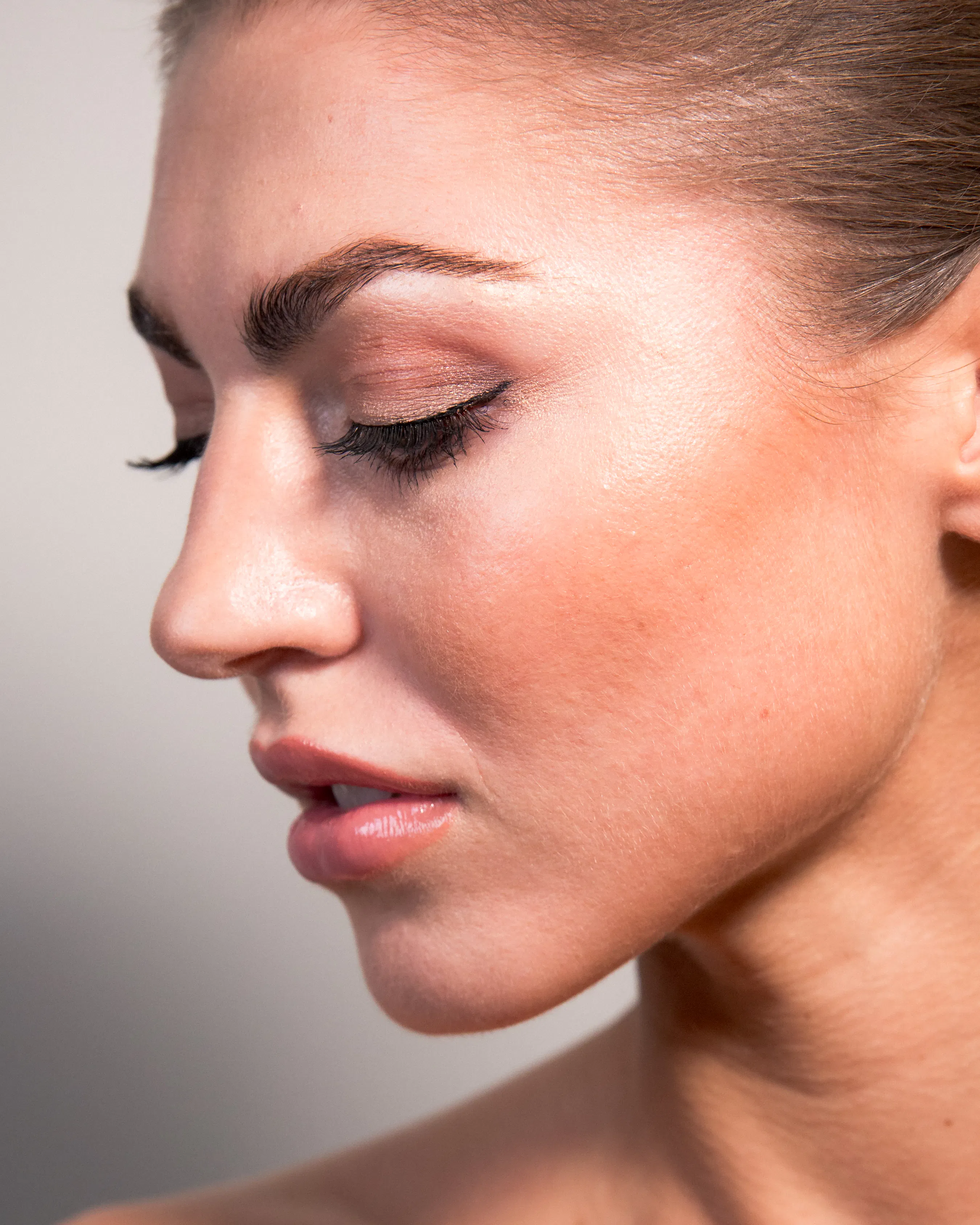 Platysma Behandlung bei SA Aesthetics in Berlin