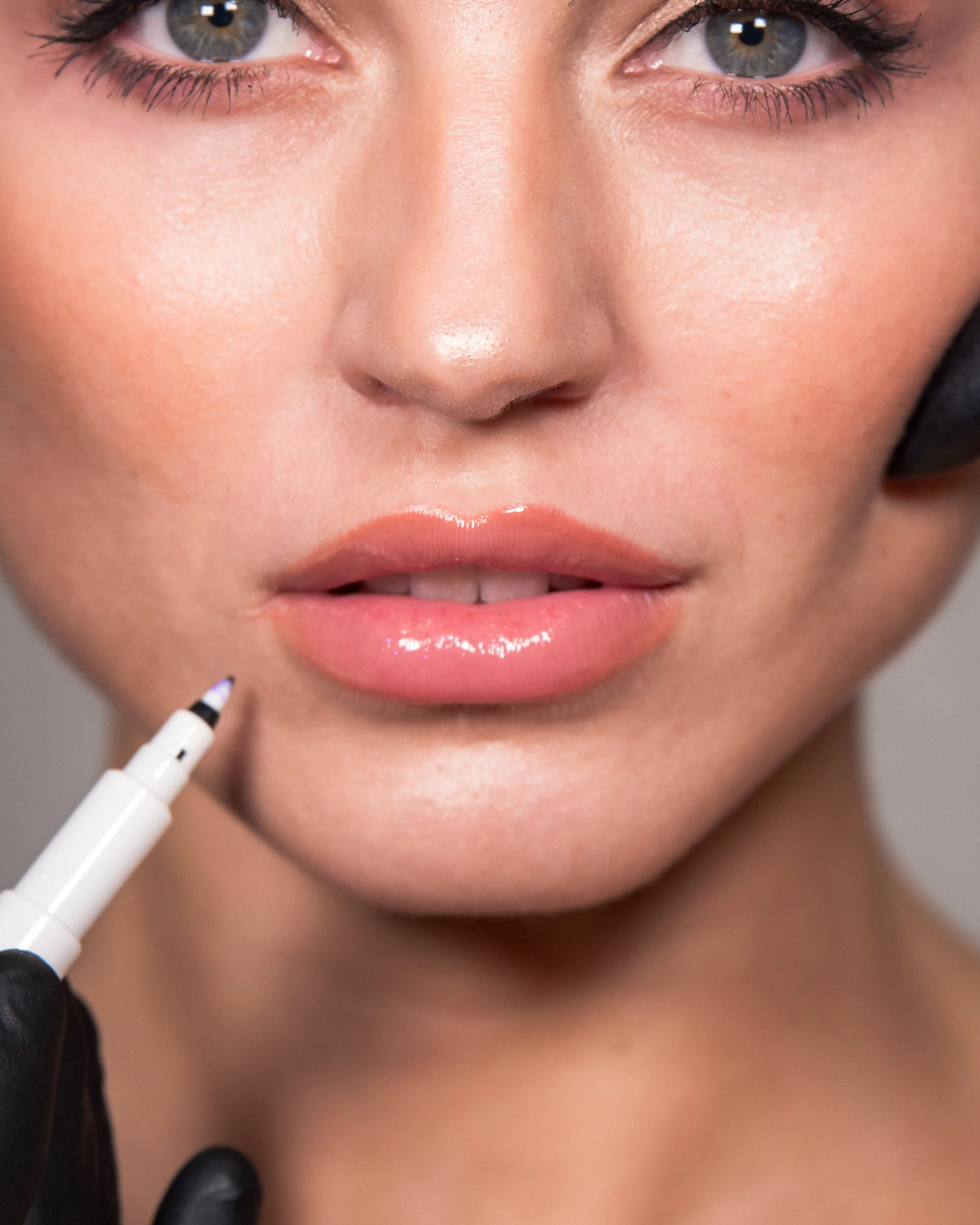 Behandlung der Lippen mit Hyaluron