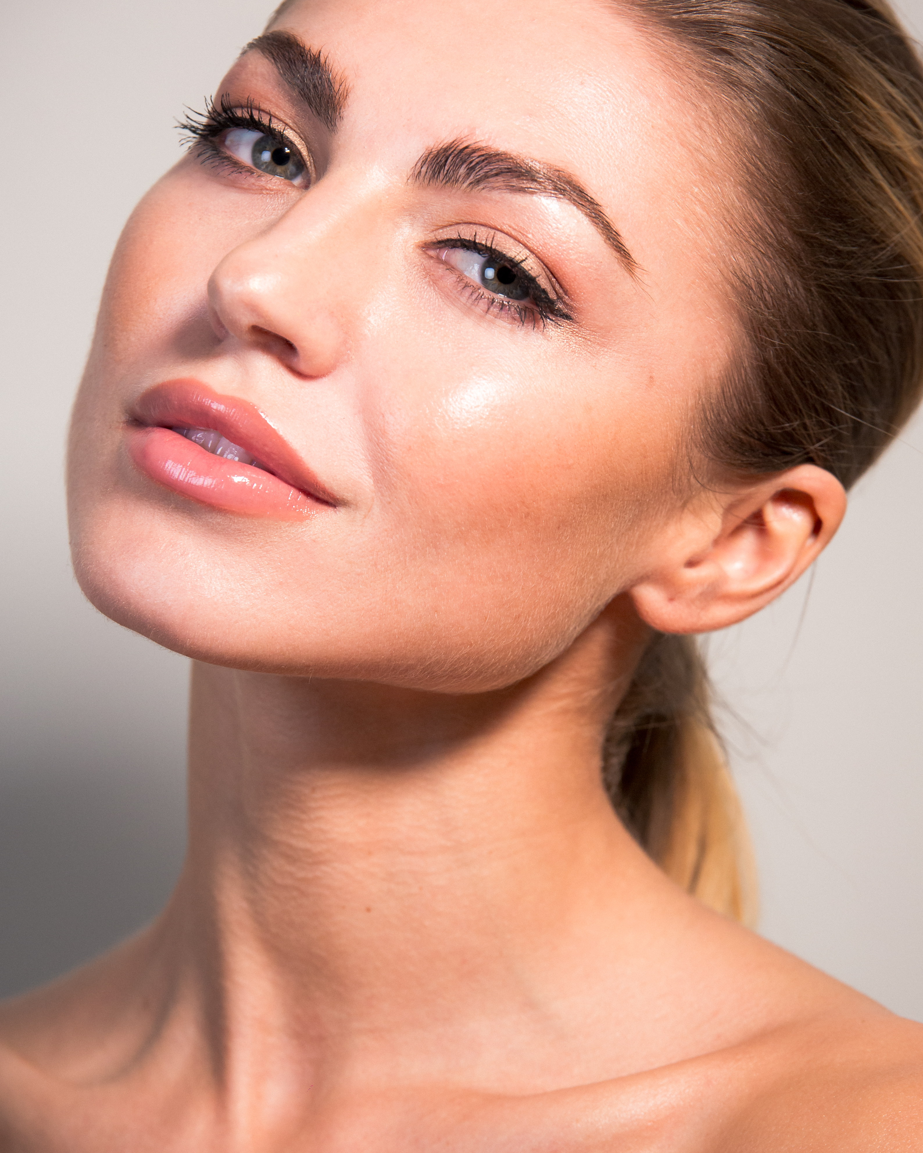 Definiertes Gesicht - Patientin - Stavrakis Aesthetics Berlin