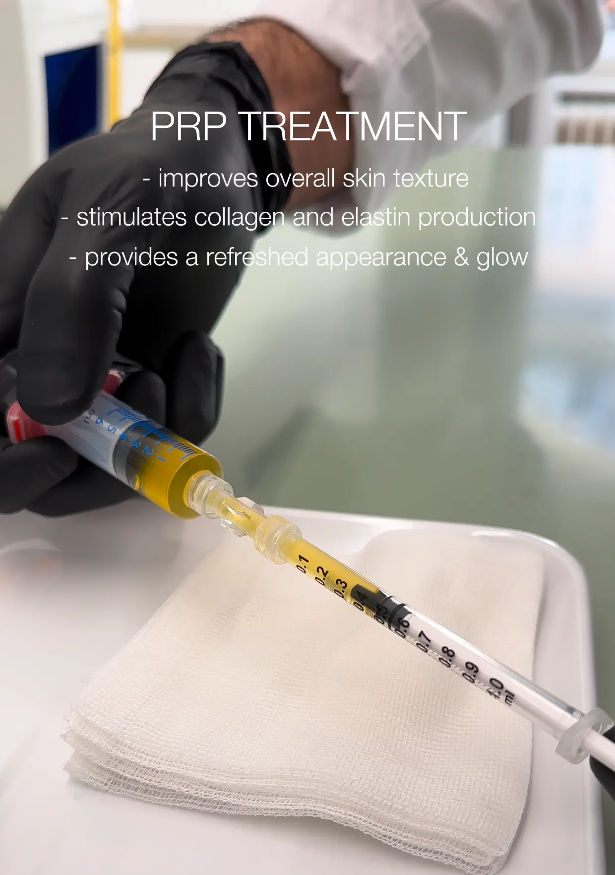 PRP Bild - Blutplasma bei SA Aesthetics Berlin