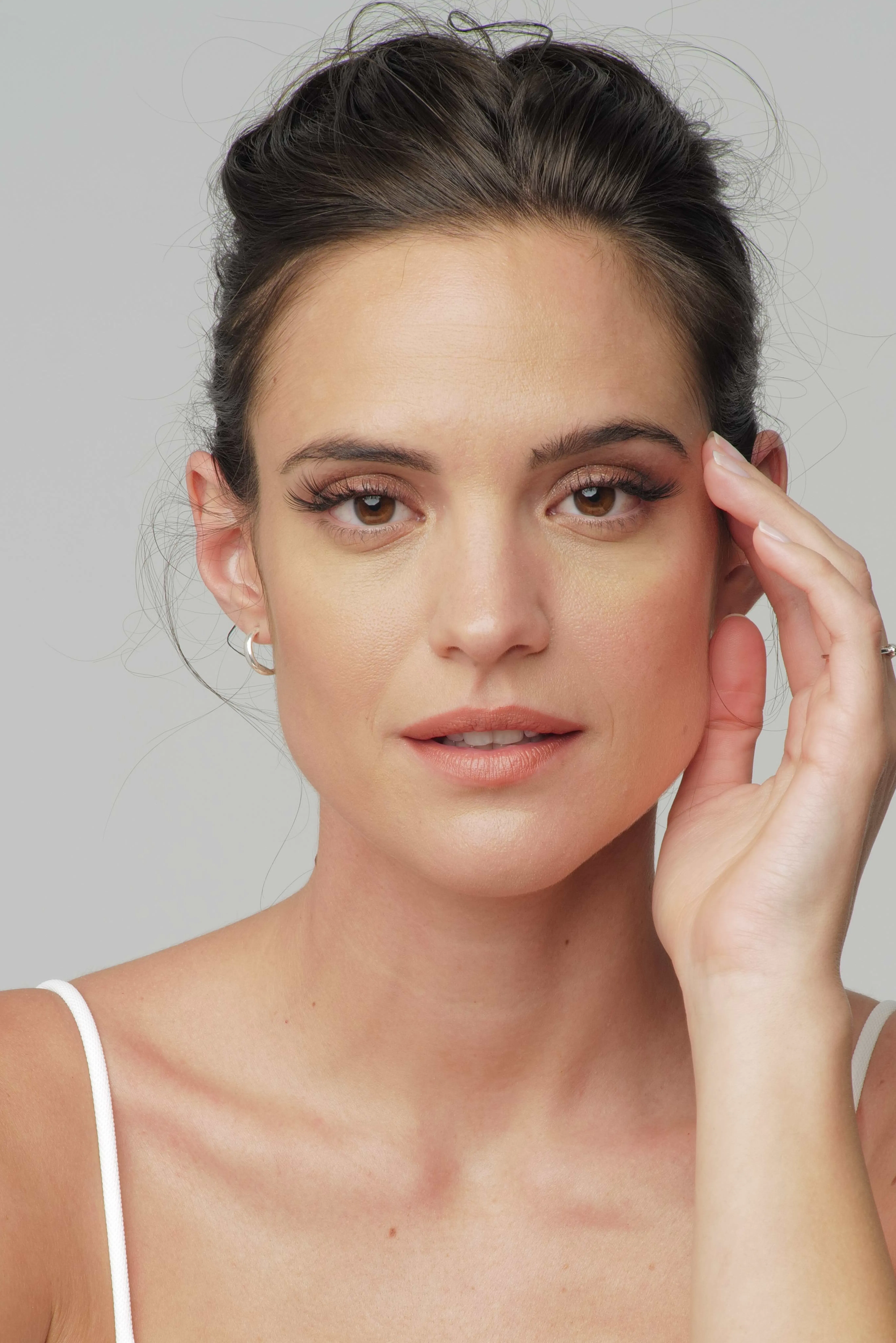 Co2 Laser Patientin - SA Aesthetics Berlin