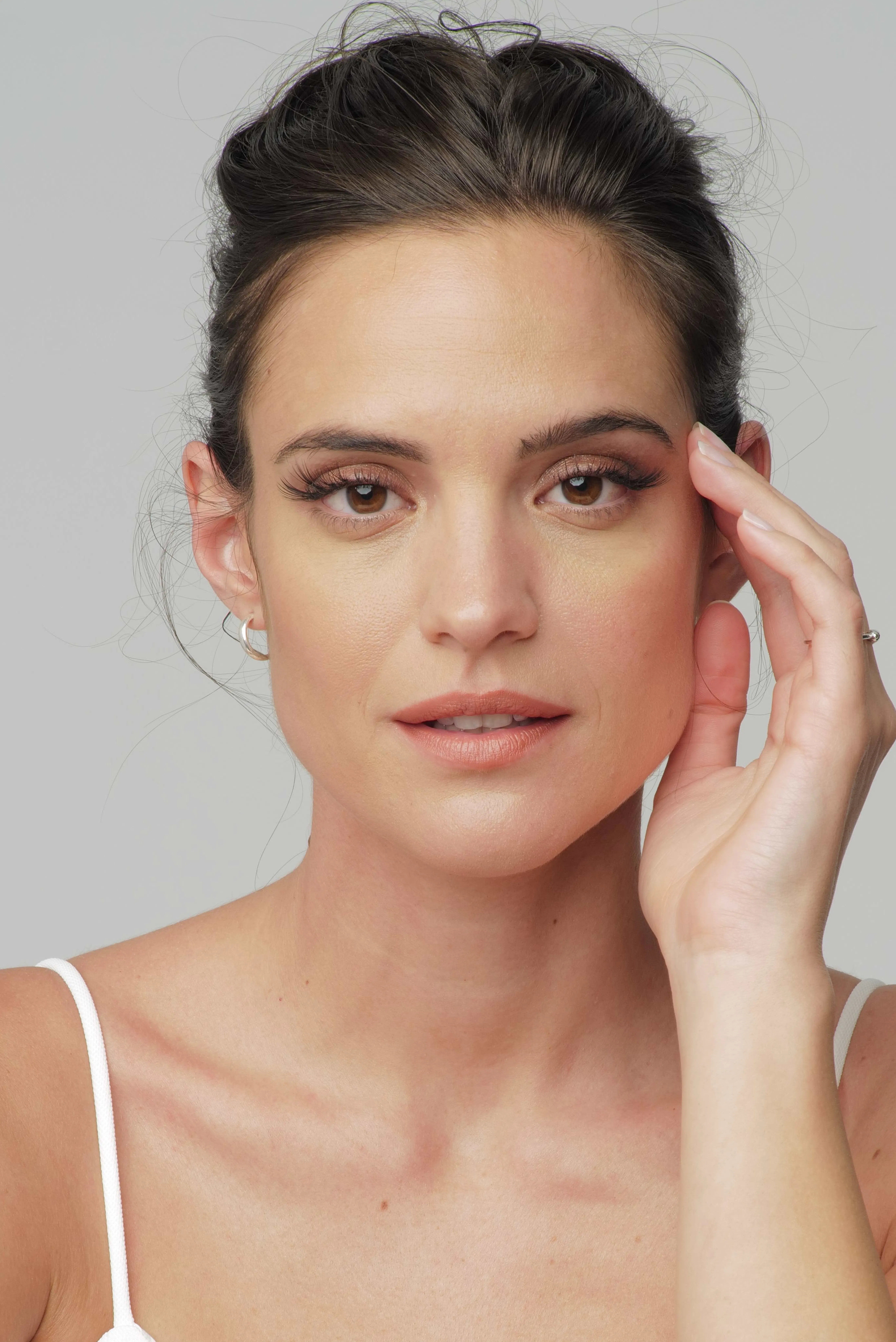 Co2 Laser Patientin - SA Aesthetics Berlin