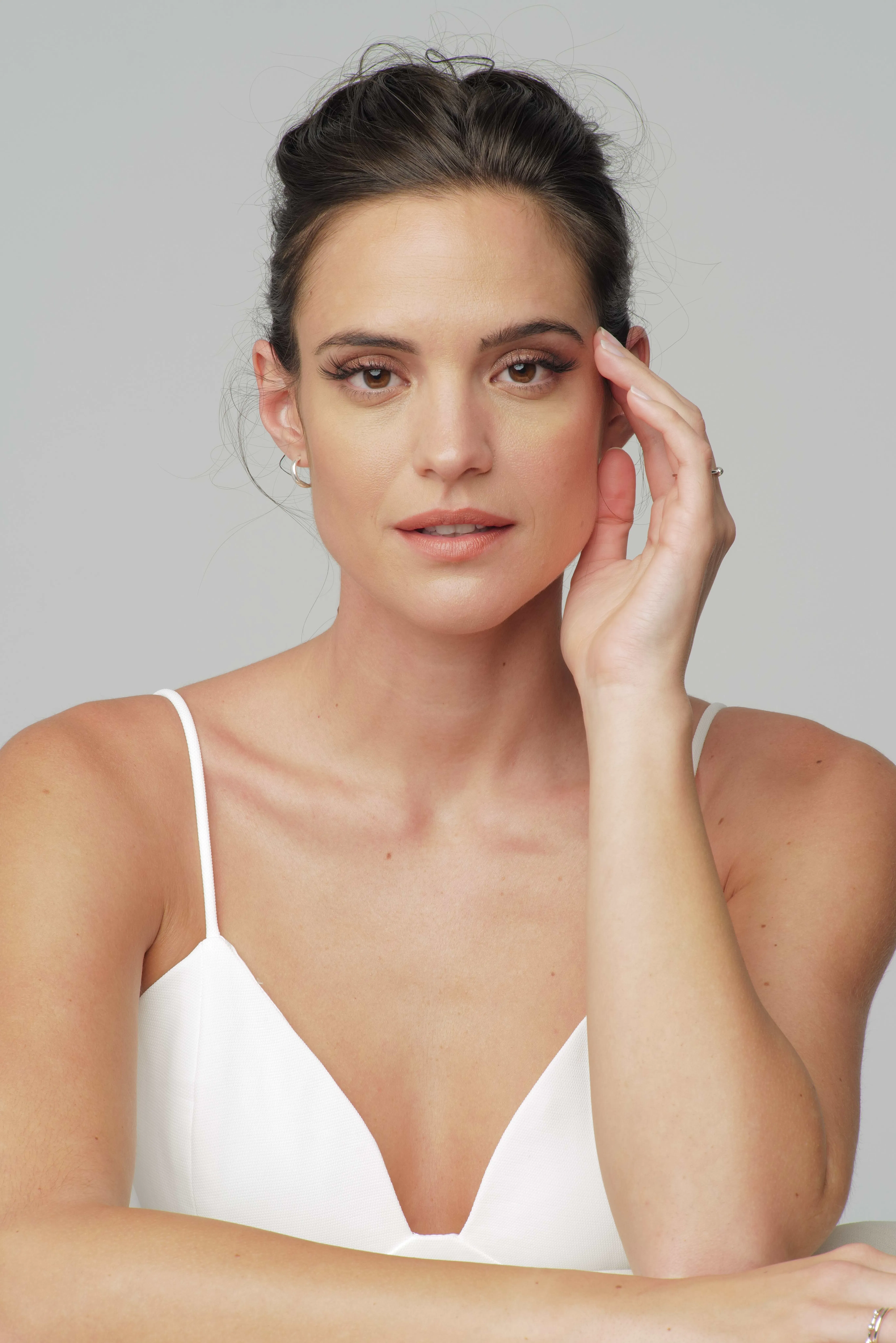 CO2 Laser Patientin - SA Aesthetics Berlin