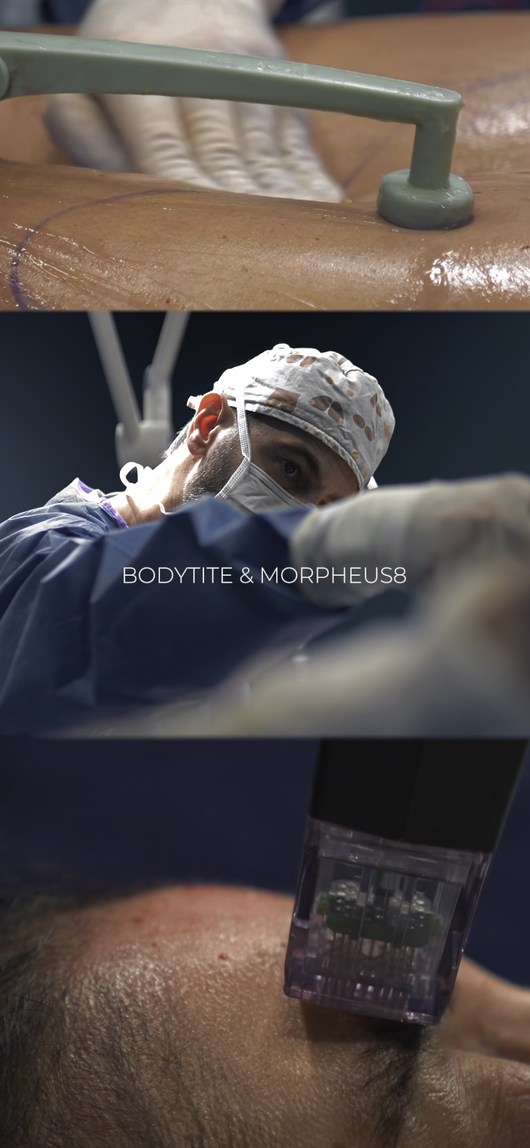 morpheus8