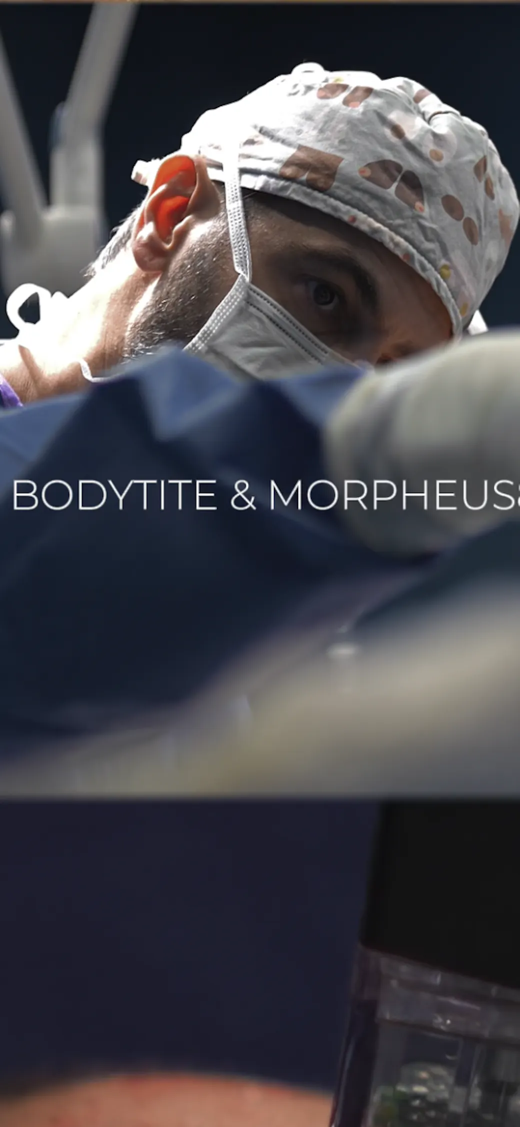 BodyTite® Hautstraffung - SA Aesthetics Berlin
