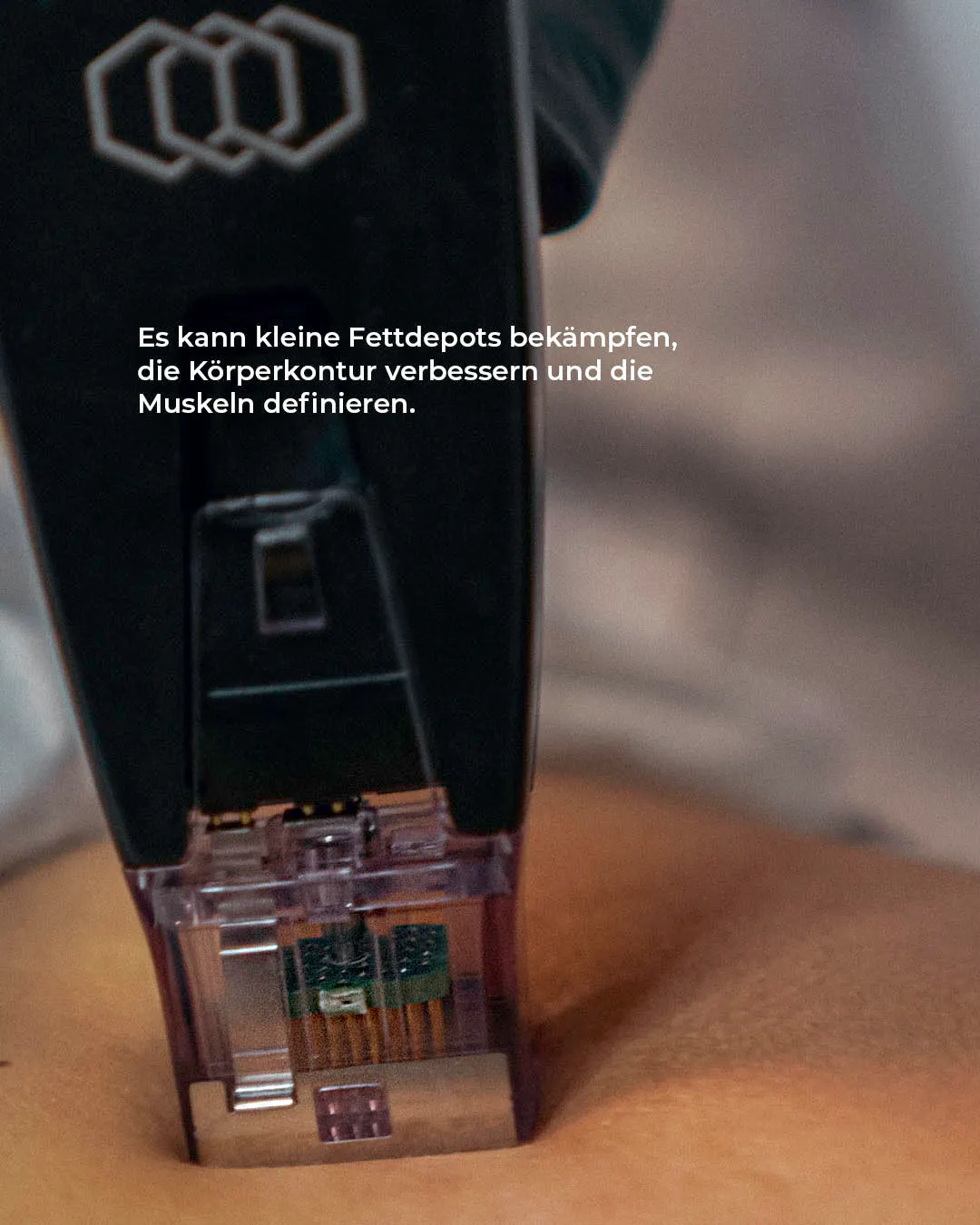 Photo von Morpheus8 Body Gerät