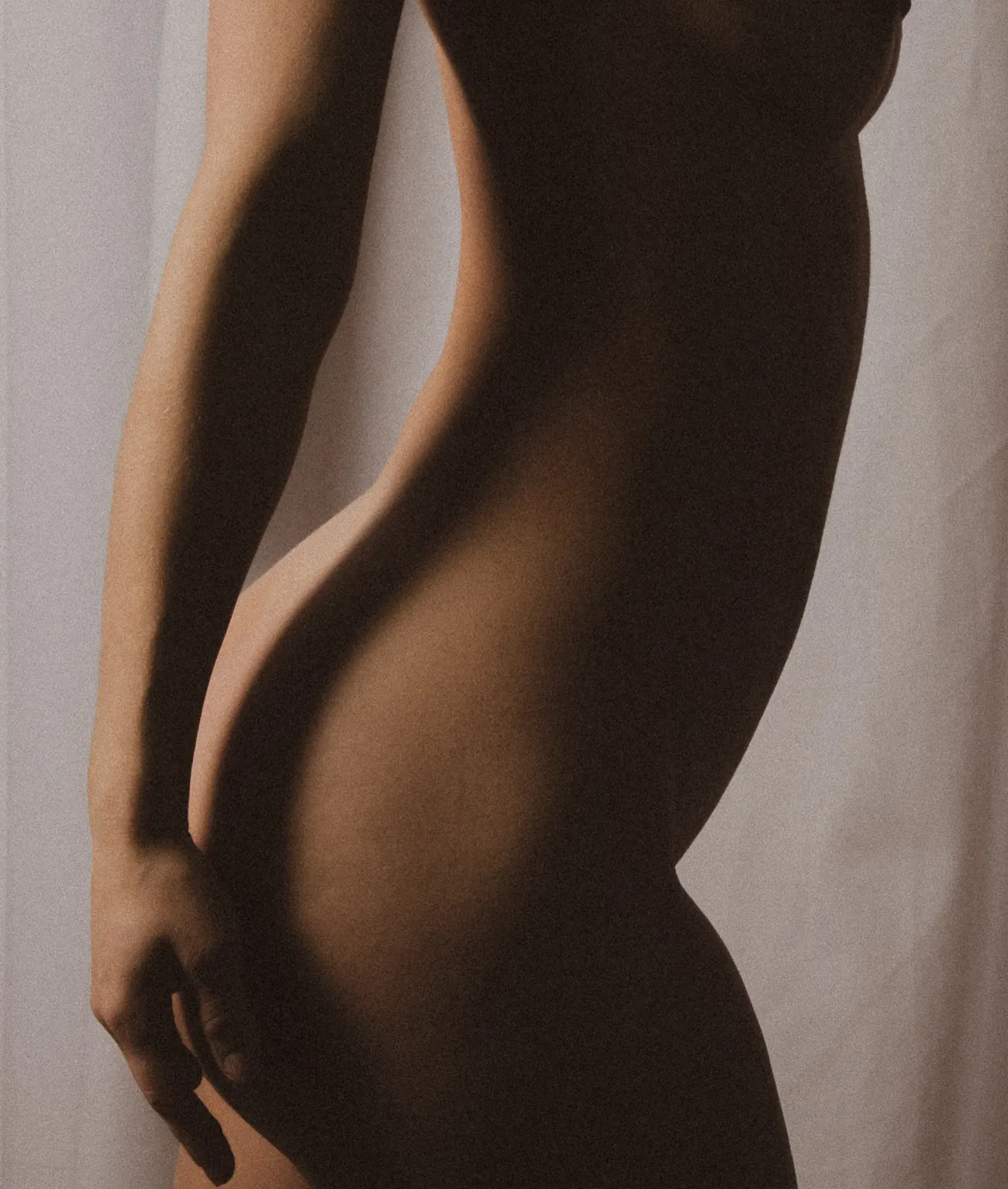 Bild von Patientin mit Lipödem - SA Aesthetics Berlin