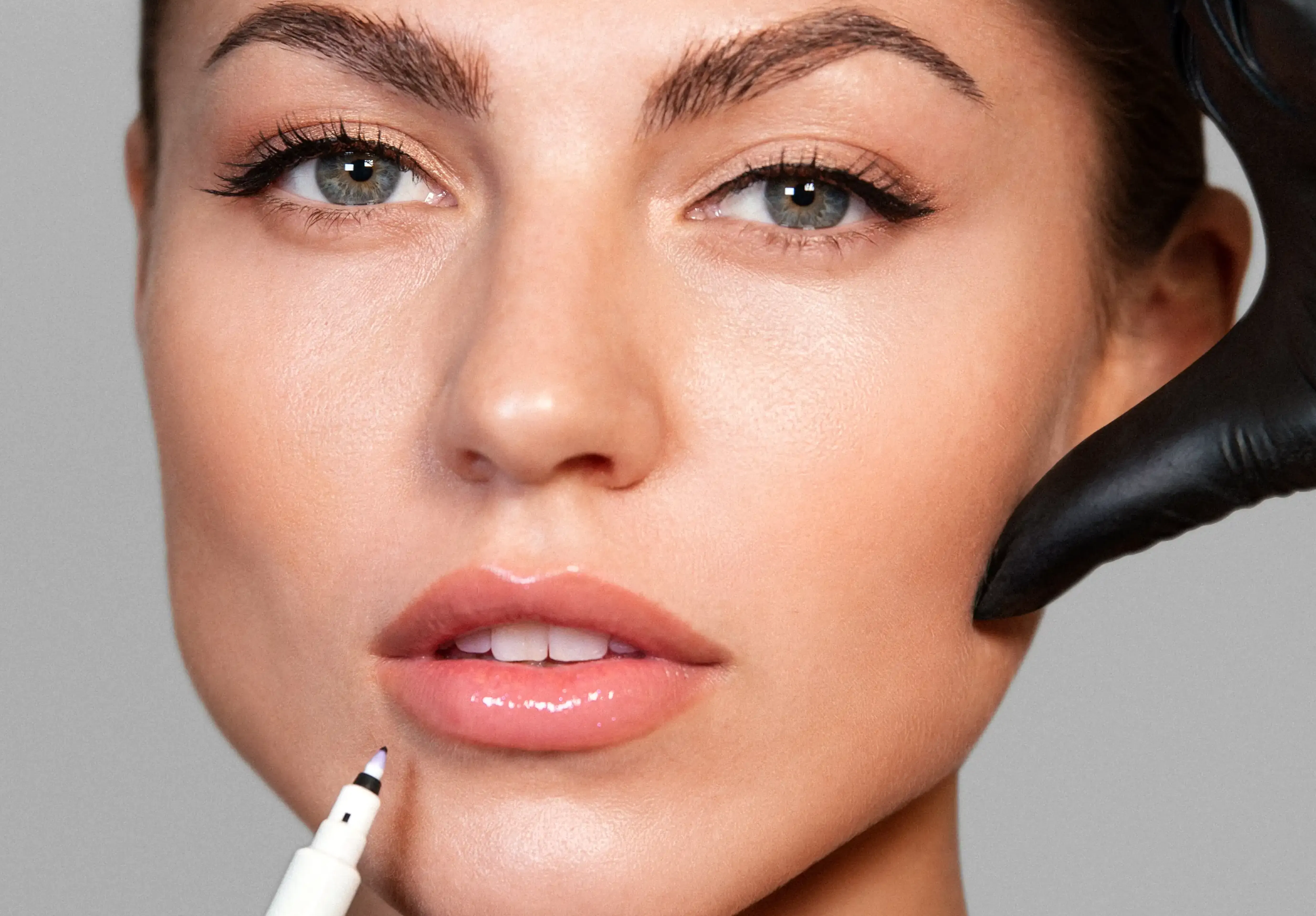 Lipflip mit Botulinum Toxin - SA Aesthetics Berlin