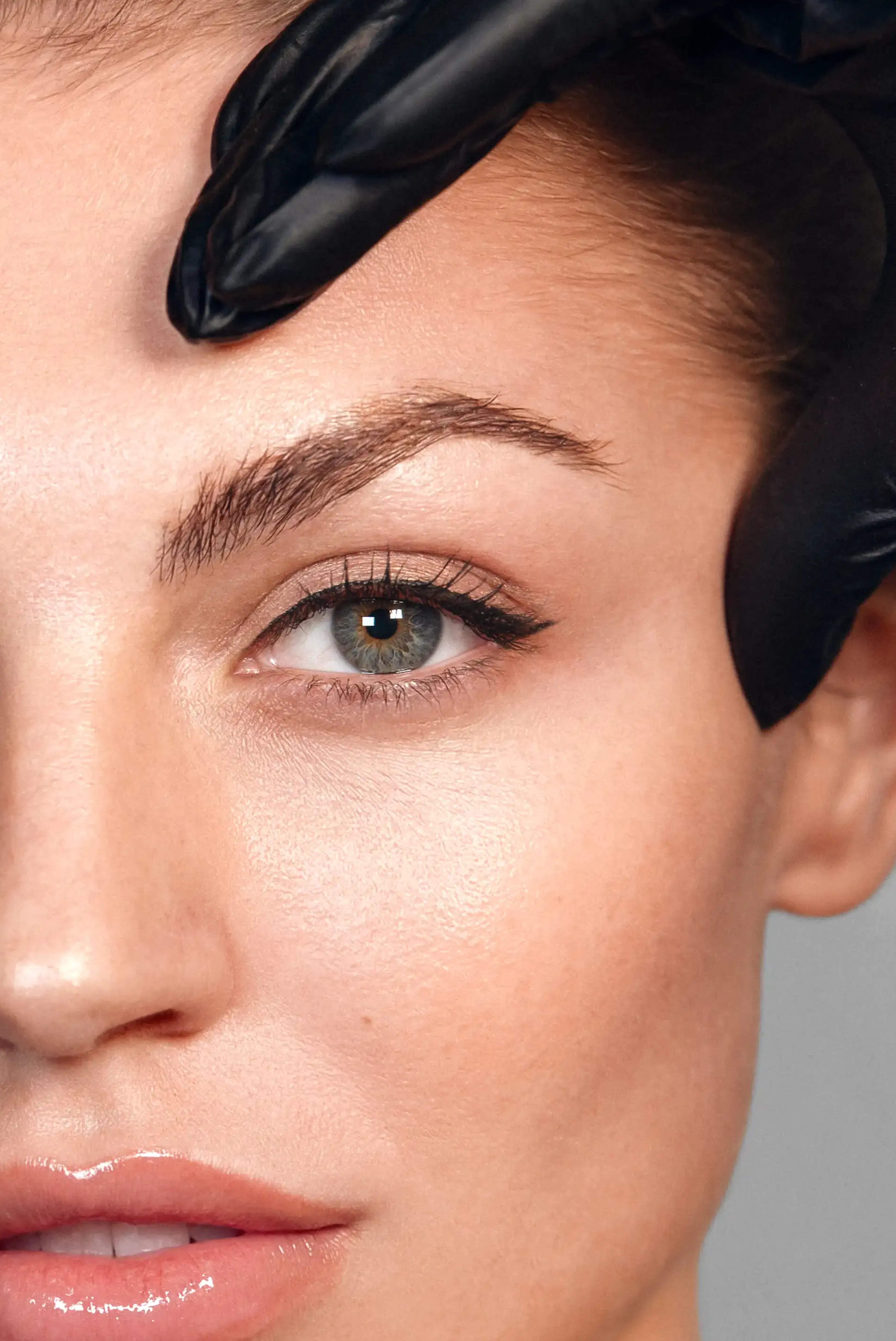 Patientin Browlift Stavrakis Aesthetics Berlin