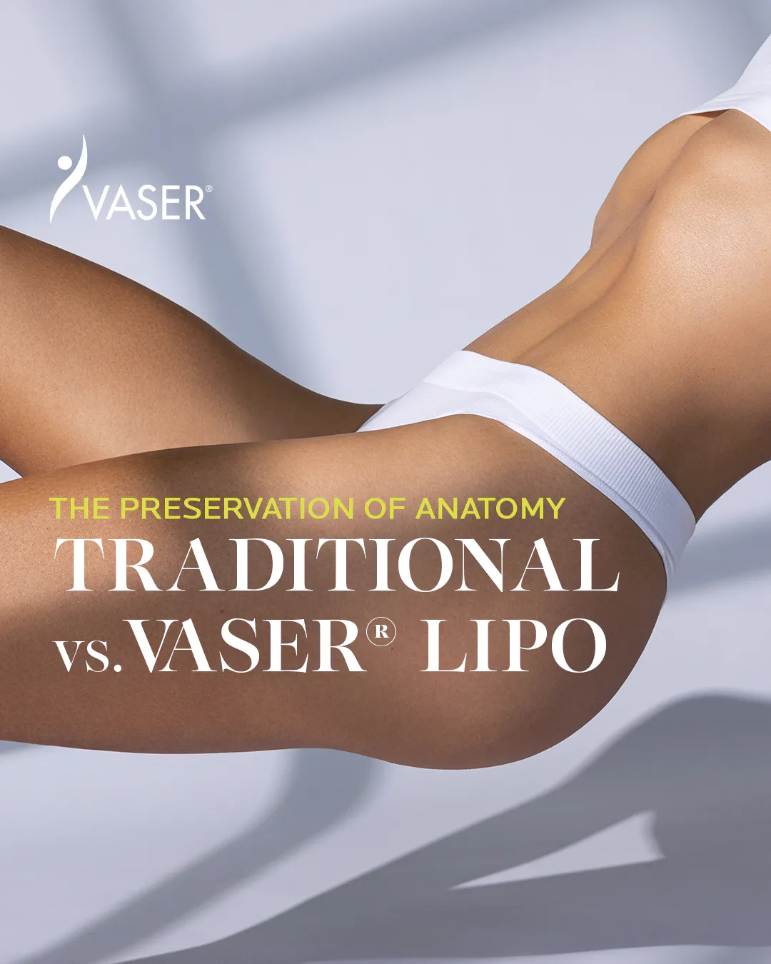 VASER Liposuktion - Bild Oberschenkel