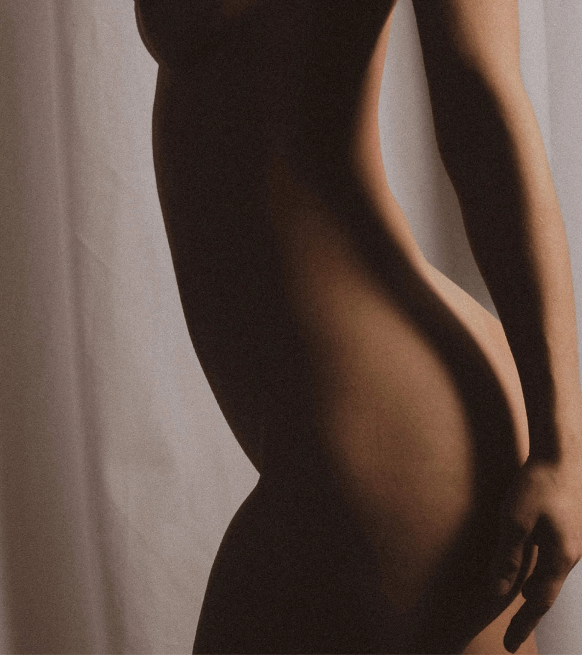 Lipödem Bild - Oberschenkel - Stavrakis Aesthetics Berlin 