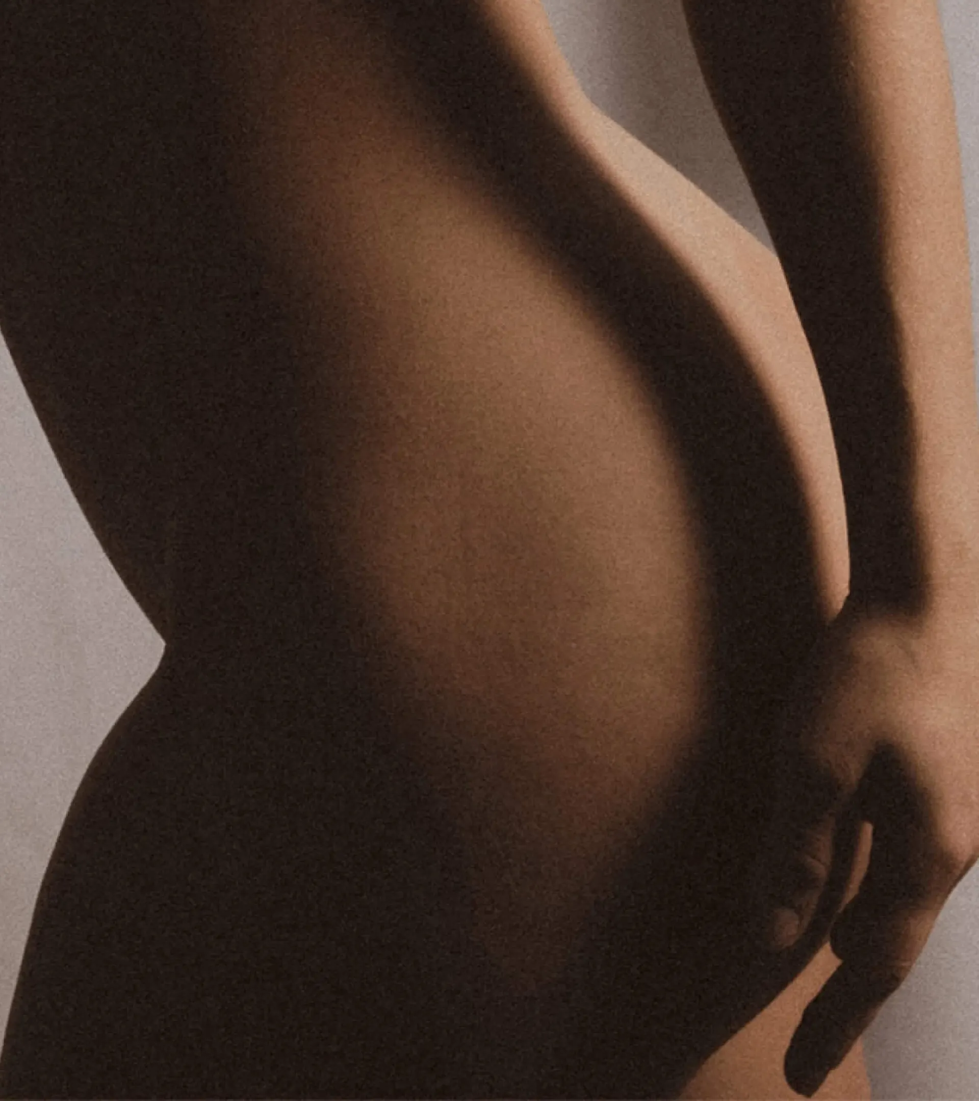 Lipödem Bild - Oberschenkel - Stavrakis Aesthetics Berlin