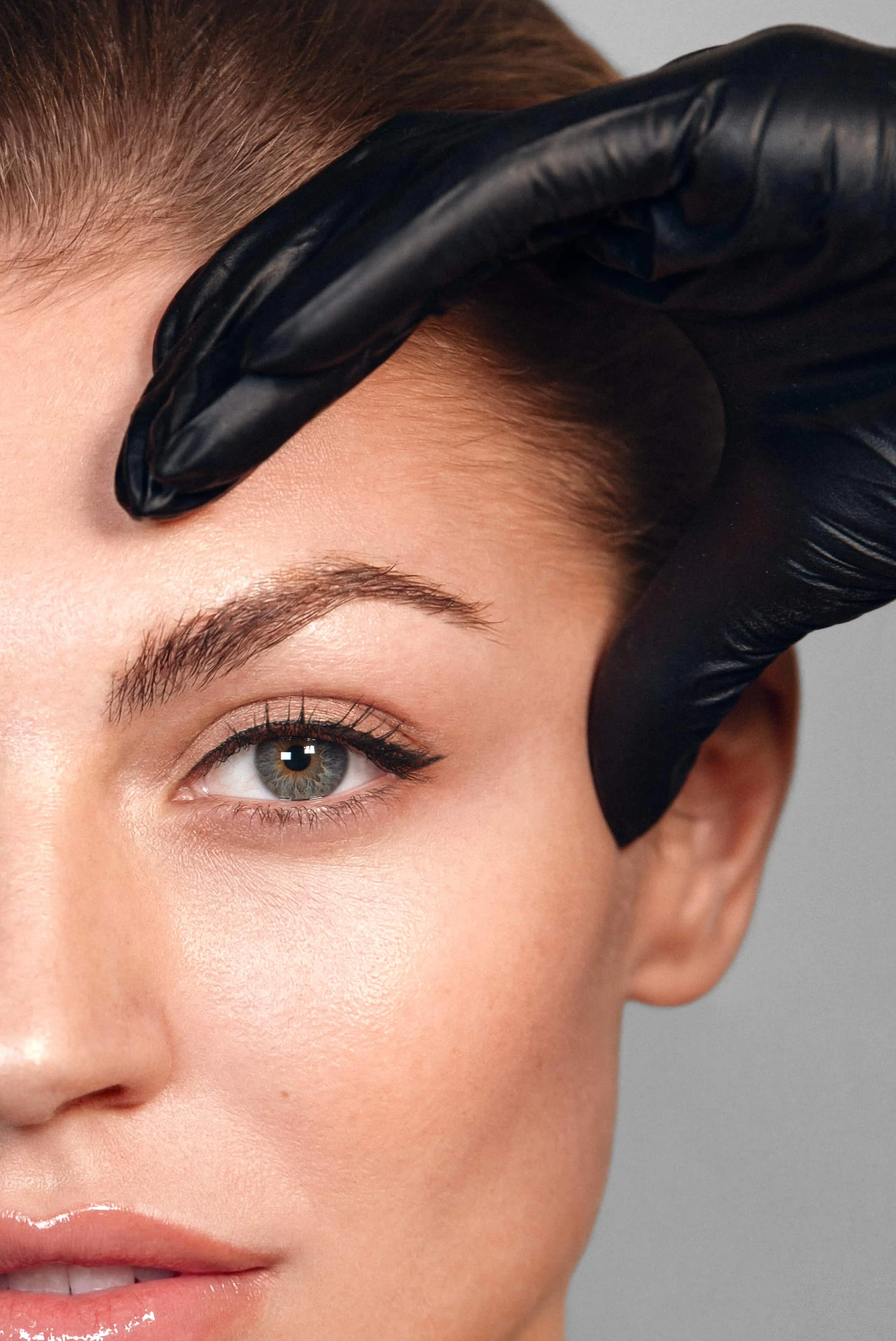 Unterspritzung Temporalregion mit Filler - SA Aesthetics Berlin