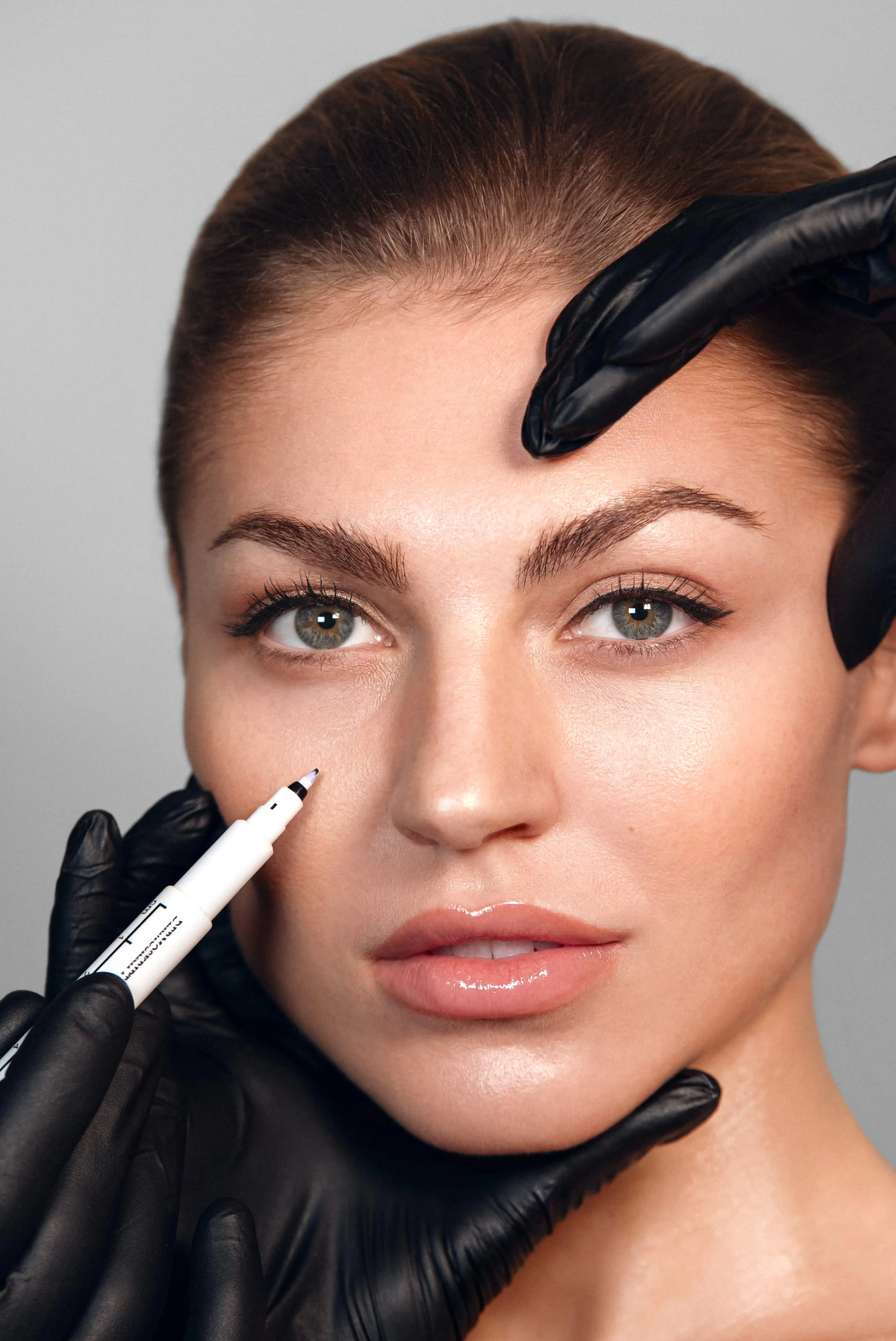 Tränenrinne Unterspritzung bei SA Aesthetics Berlin