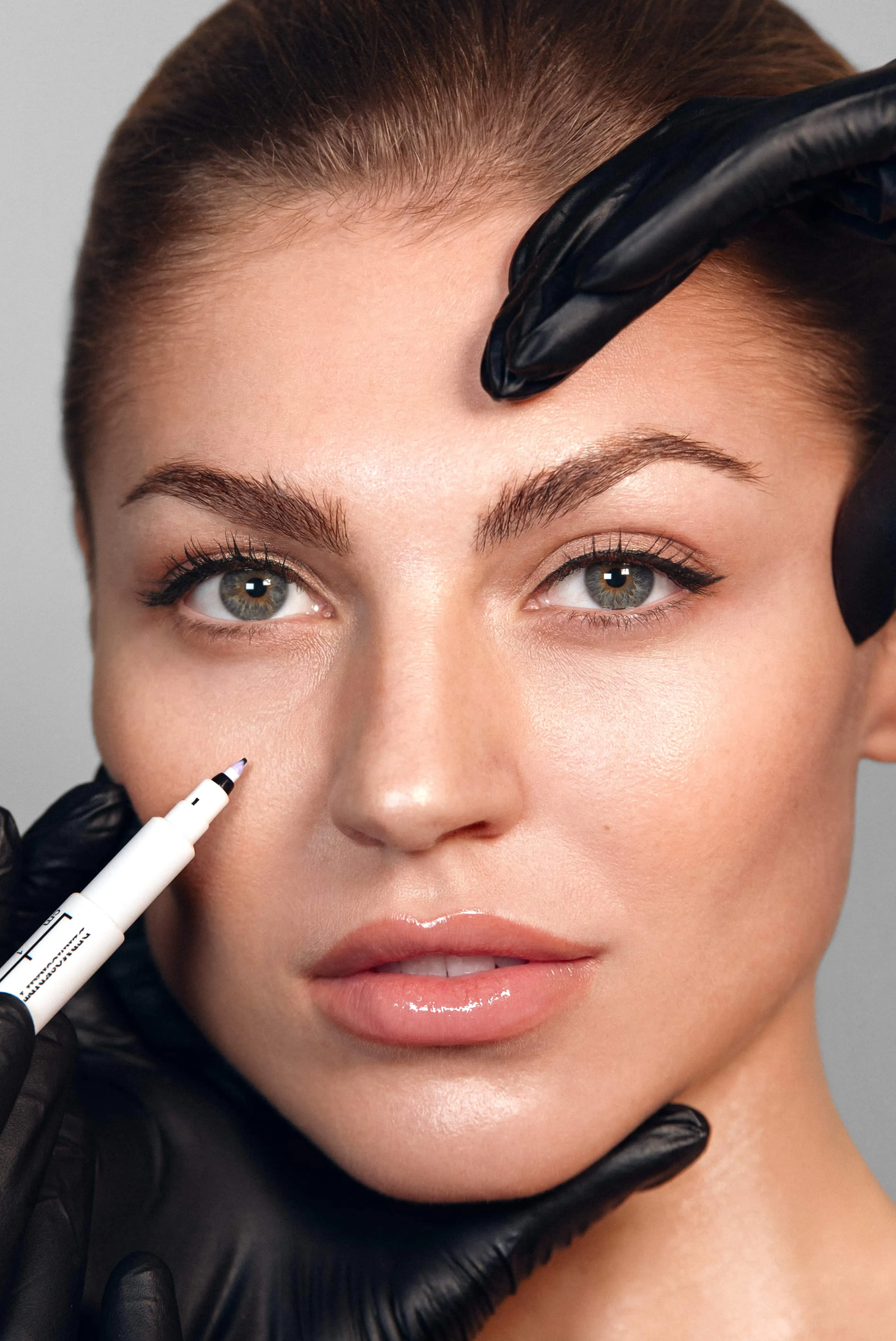 Behandlung der Nasolabialfalte - SA Aesthetics Berlin