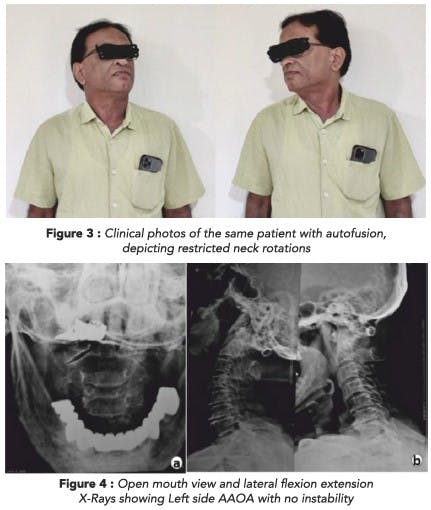 Spinal Health: Focusing on the Head and Tail Ends