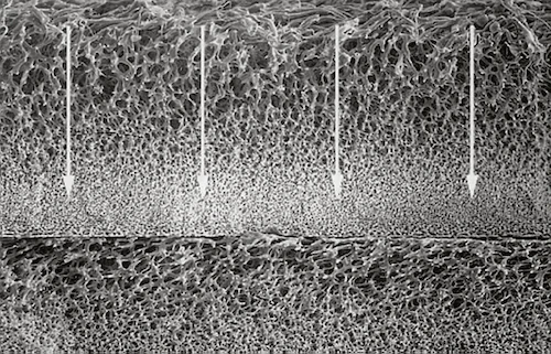 Blood Separation Membranes