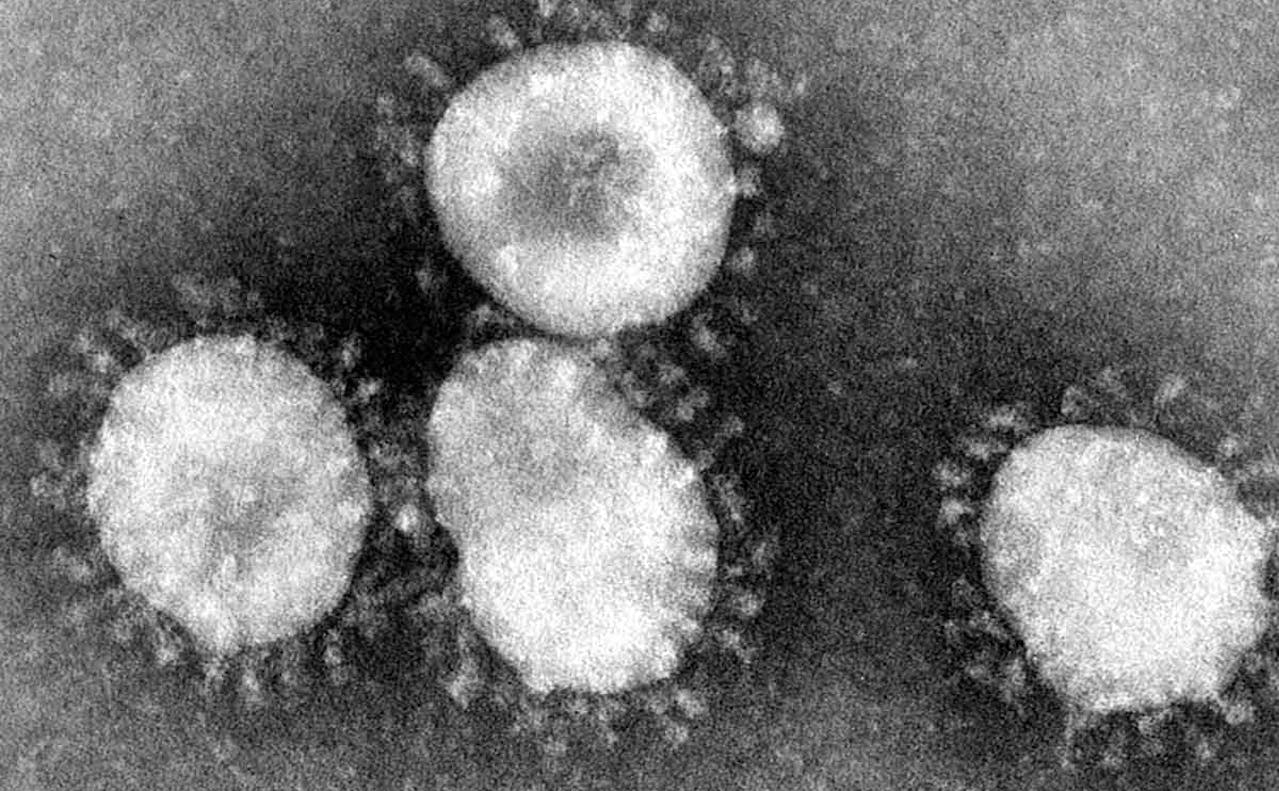 koronavirus privatøkonmi