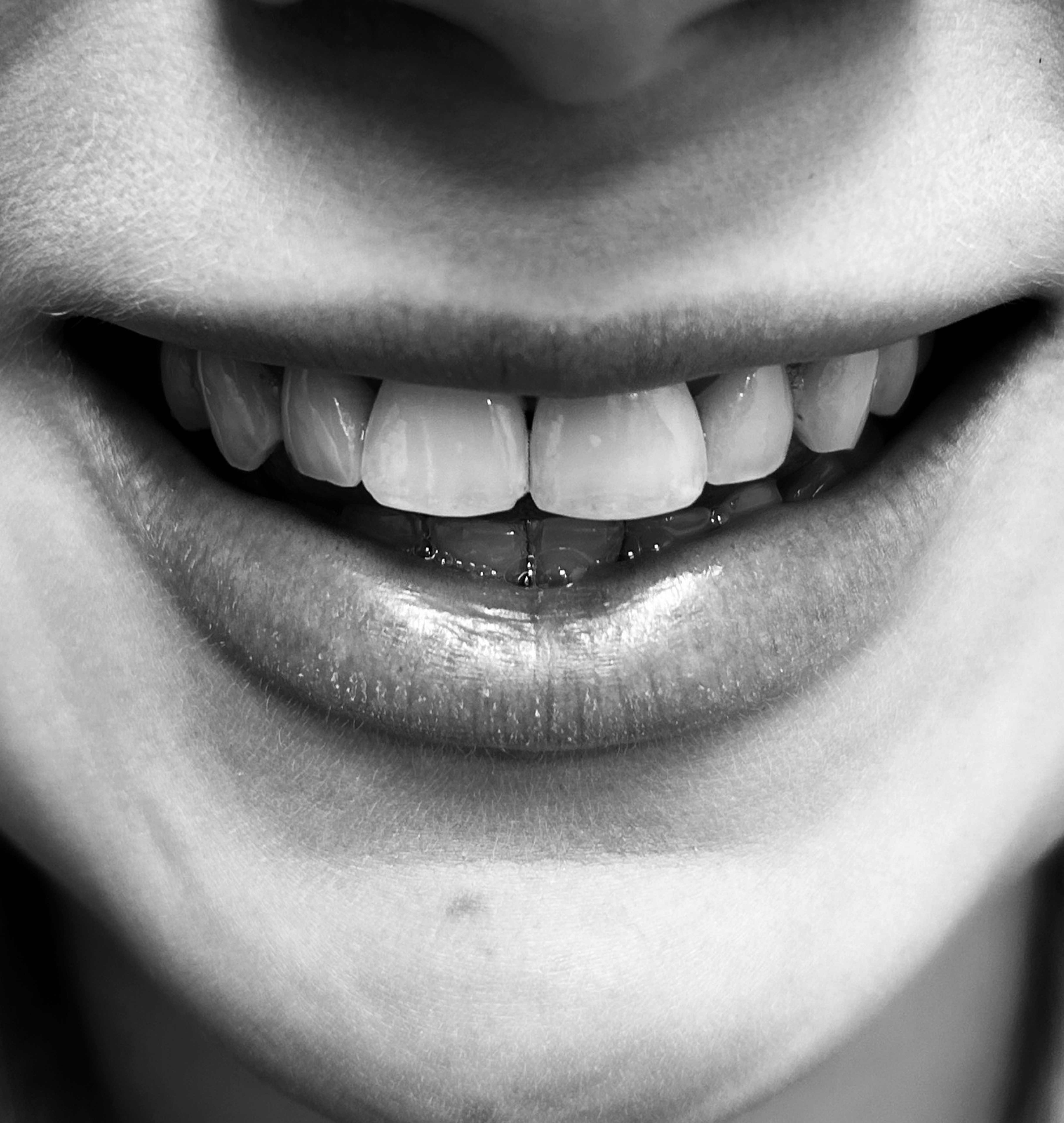 Regeneracja i wybielanie zębów Stomadent Radomsko