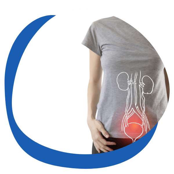 Cystitis relief illustration – A woman in a grey t-shirt highlighting the urinary system, with bladder inflammation marked in red. Suitable for UTI and bladder infection treatment products.