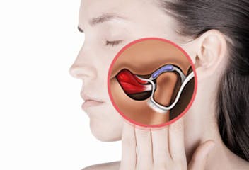 dentista gnatologo bergamo