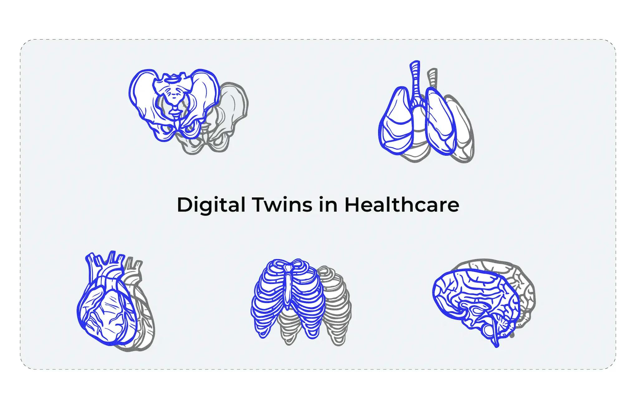 Digital Twins Current Applications in Medicine