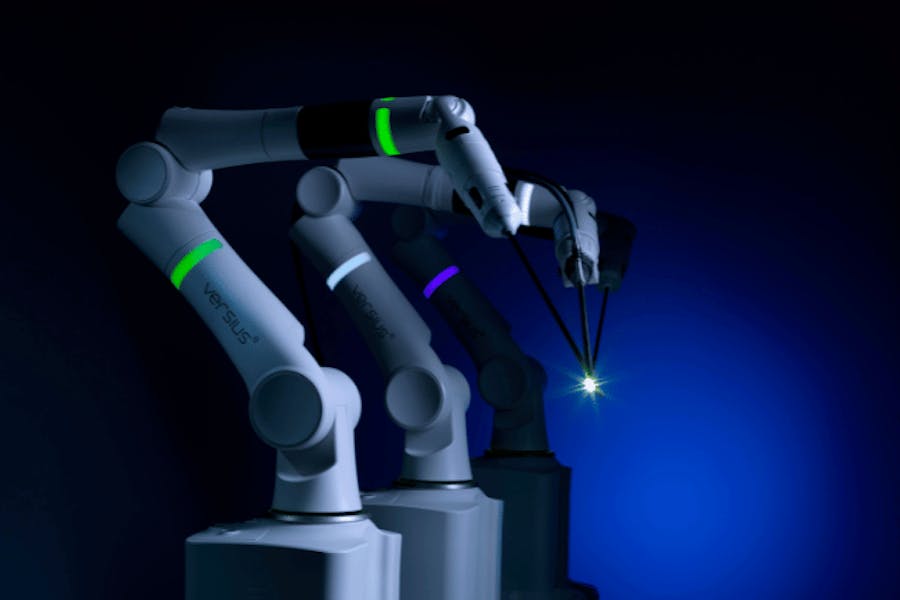 Wycięcie trzonu macicy za pomocą robota Versus – najczęściej zadawane pytania