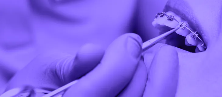 Prevención y cuidado: la clave para una sonrisa sana