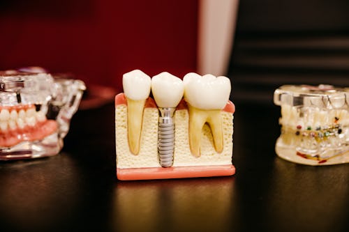 Artificial tutorial structures for illustrating dental implants