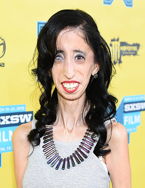 Meet Lizzie Velasquez The Ugliest Woman In The World   D94540ea E824 4103 Ba55 72936410ceec Gettyimages 466200076 612x612 