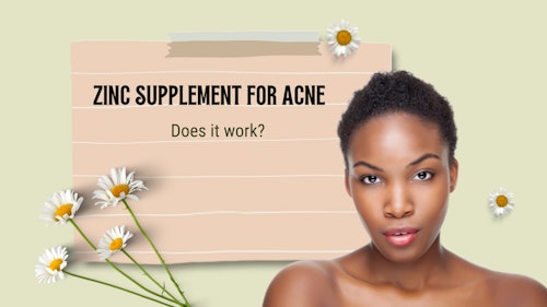 Black girl with smooth face and no acne