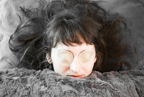 A girl with sleeping beauty syndrome (kleine-levin disorder)