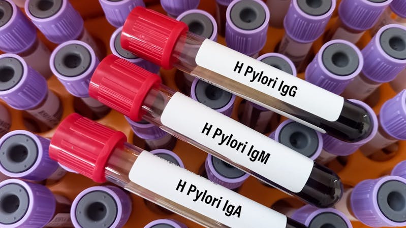 Sample for conducting H. pylori test