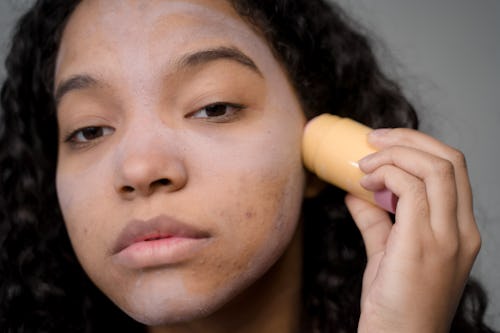 image of a girl with acne applying concealer make up