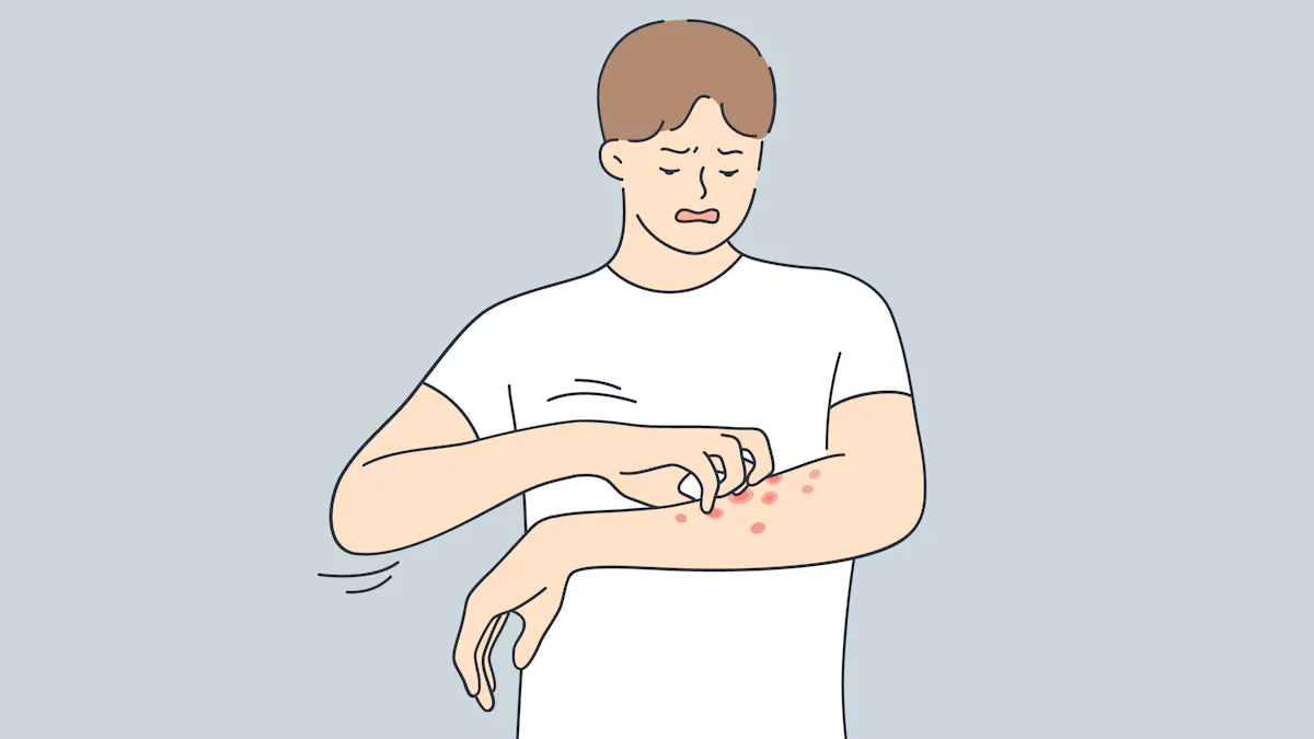Prednisone Rashes Prednisolone for skin rash: Dosage, safety, side effects, precautions