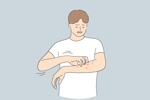 Image illustration of a man with skin rashes scratching his arms