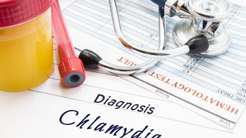 Chlamydia is an STD that can be transmitted both via vaginal and oral sex