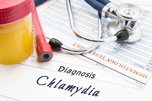 Chlamydia is an STD that can be transmitted both via vaginal and oral sex