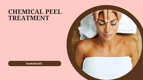 Hero image of a woman getting a chemical peel for skin treatment