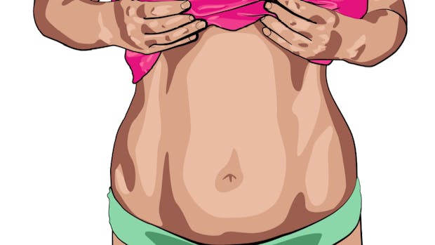 Avatar illustration of a woman with increased belly fat