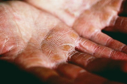 Image showing two dry hands with the palms turned upwards