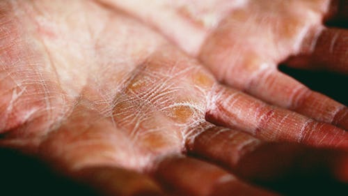 Image showing two dry hands with the palms turned upwards