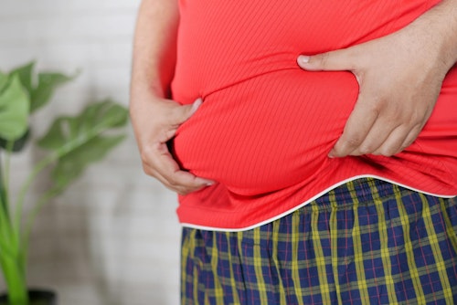 Image of a man with obesity clutching the fat around his abdominal area