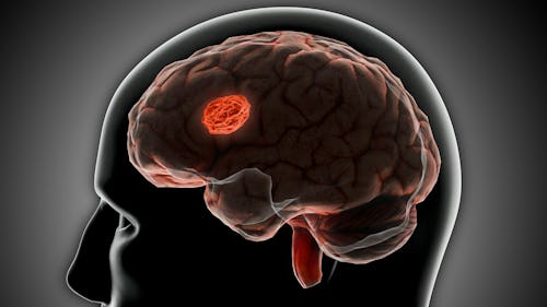 image showing the cerebrum of the brain