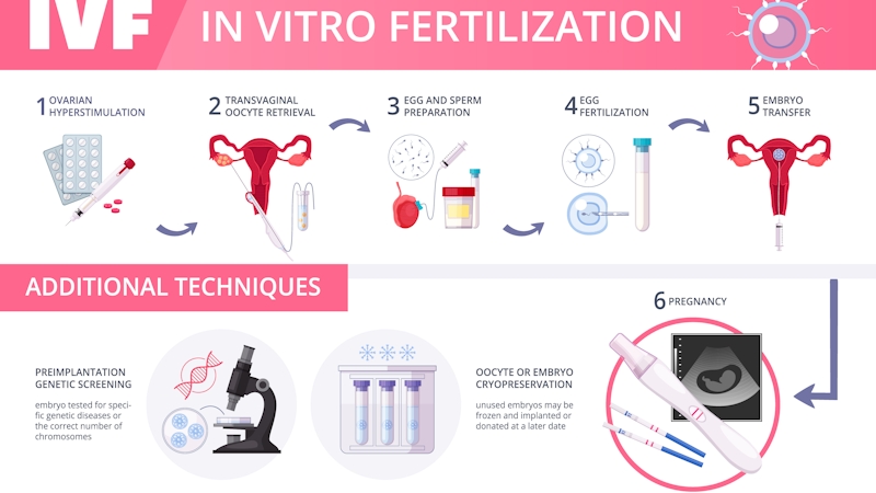 Image of invitro fertilization (IVF) procedure