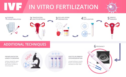 Image of invitro fertilization (IVF) procedure