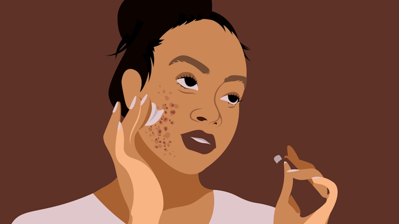 Vector illustration of a woman with pimples