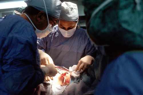 Surgeons doing a surgery to remove metastatic tumor in the brain