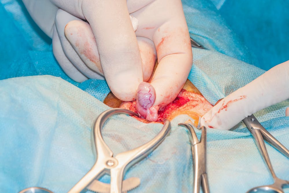 after penectomy 