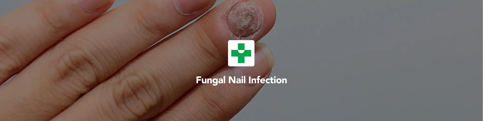 Fungal Nail Infection